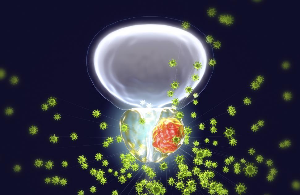 cancer prostate pesticide