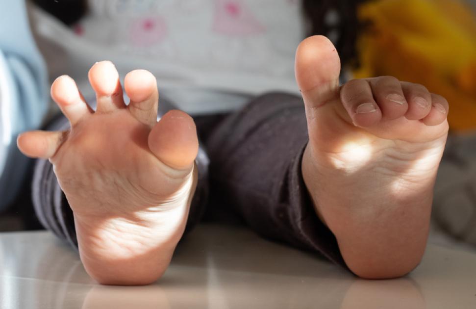 Association arthrogrypose.fr : échanger des conseils pour faire avancer le soin