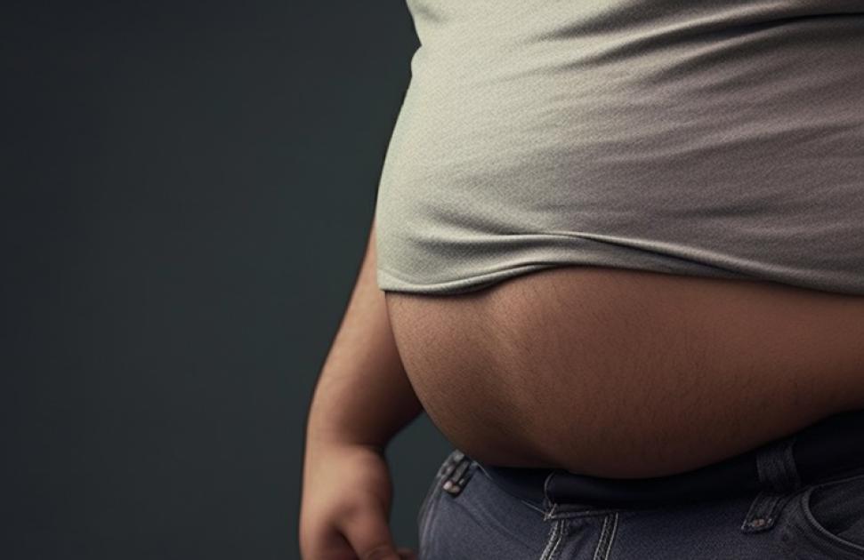 Timéo. Traitement innovant multi-évaluations de l'obésité