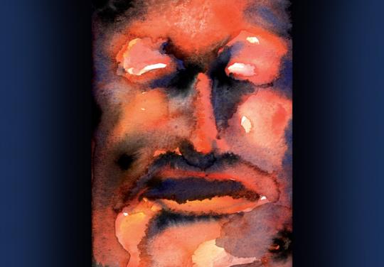 Acromégales, pas seulement… : "Il n’y a pas que les cas extrêmes"