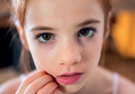 associationeczema.fr : comment aider les patients à rester "PEAU-sitifs"