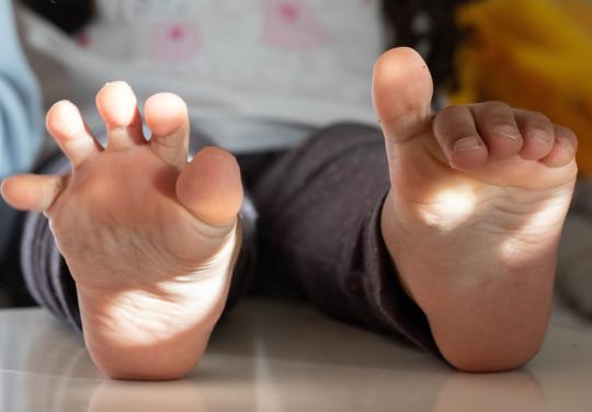 Association arthrogrypose.fr : échanger des conseils pour faire avancer le soin