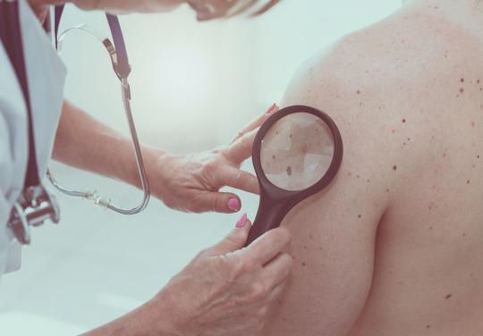 La Société Français de dermatologie lance Mobil'derm, "une réponse concrète et pragmatique à un enjeu majeur de santé publique"